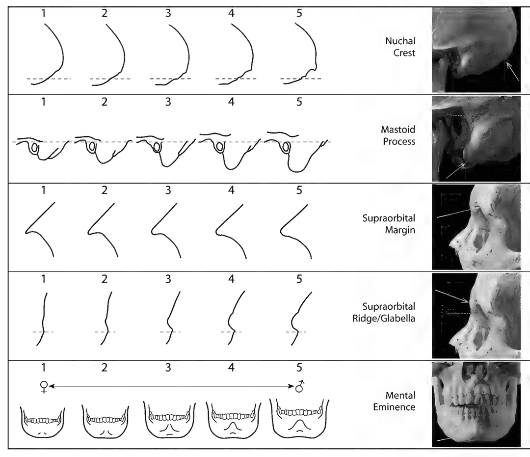 Sex estimation with the skull
